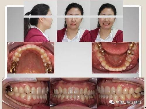 成年女人性视频,真实视频背后的故事